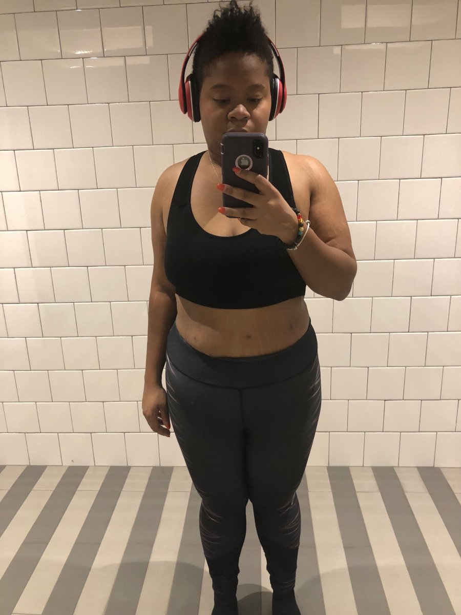 8-Month Post Op