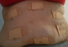 belly 2 days after