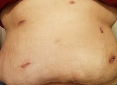 belly 2 weeks after