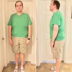 1 Year Post Op