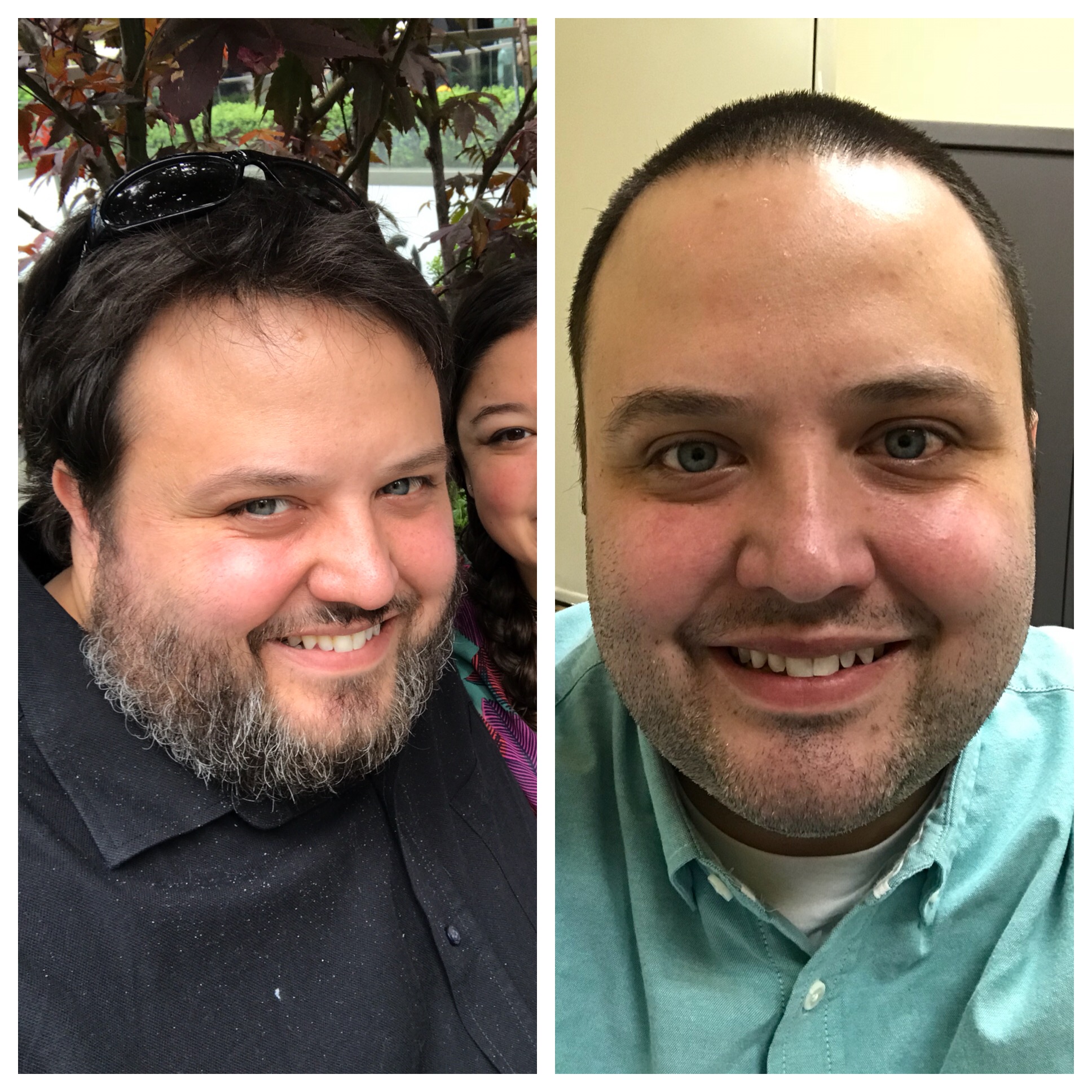 3 week’s post op pics