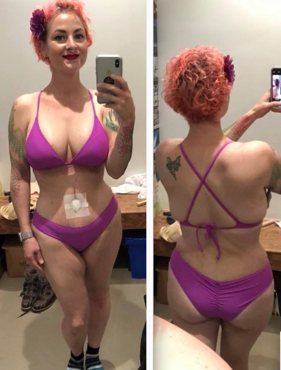 4 weeks post op copy.jpg