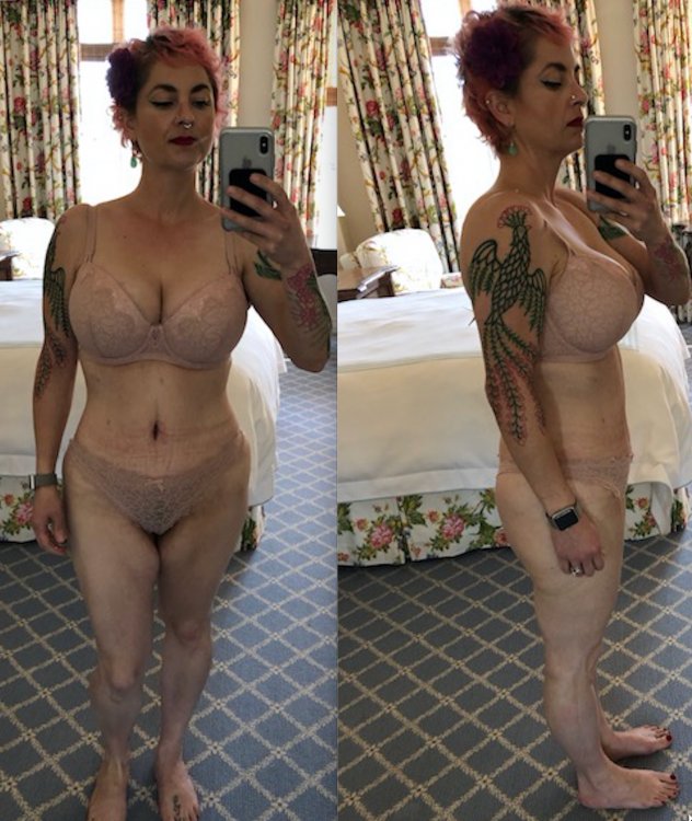 8 weeks post op copy.jpg