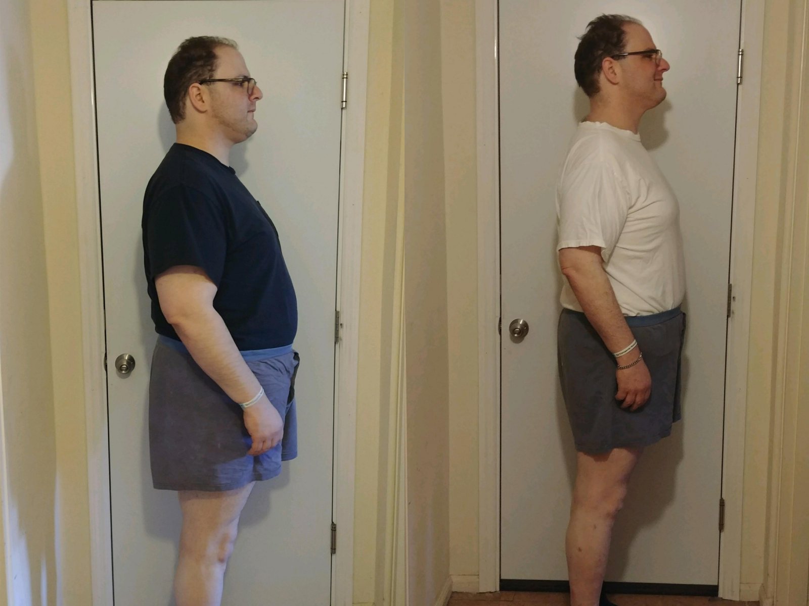 4 Weeks Post-Op