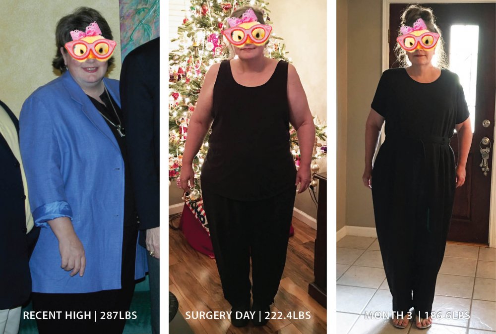 2017-2018WLS_BA_3months.thumb.jpg.84377f55d2c35044d8541aa3be778123.jpg