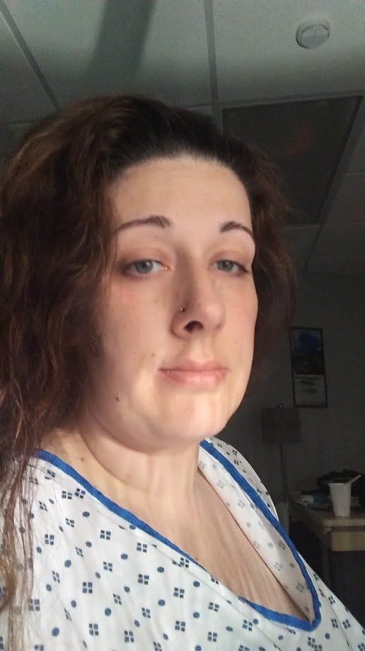 Bariatric Journey