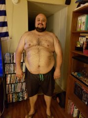 Before Surgery on 08/31/18