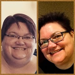 Pre and Post Surgery.jpg