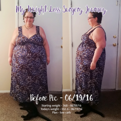 June 19 2016 - Before surgery