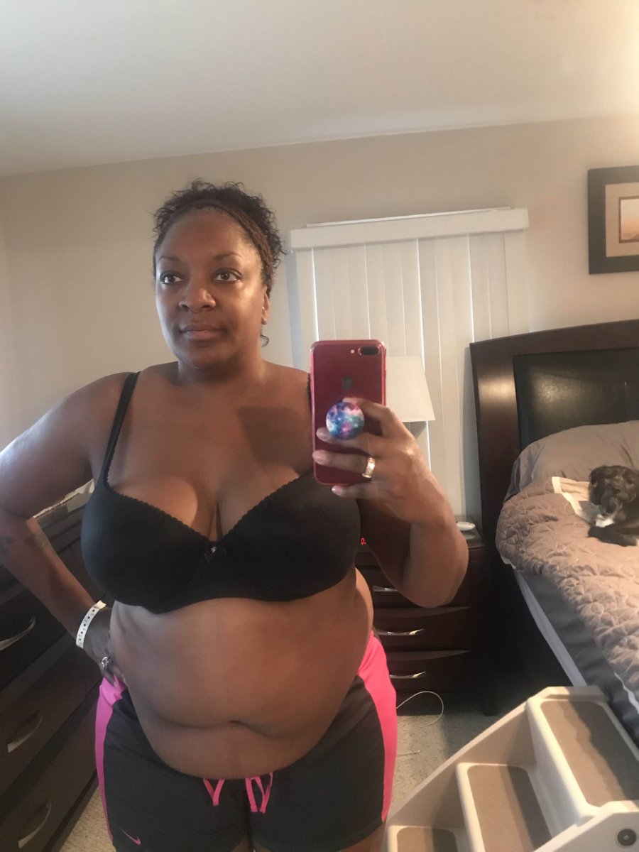 The day before surgery