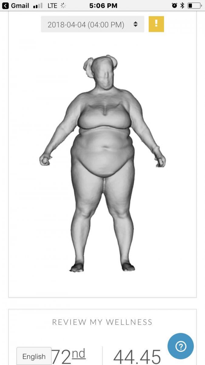 Weight I lost before surgery 
