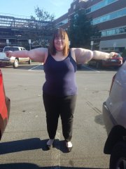 10.31.18 PreOp arms.jpg