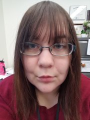 11.30.18 PostOp Face.jpg