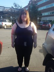 10.31.18 Preop front.jpg