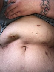 Ouch
