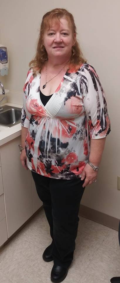 4 Months after surgery
