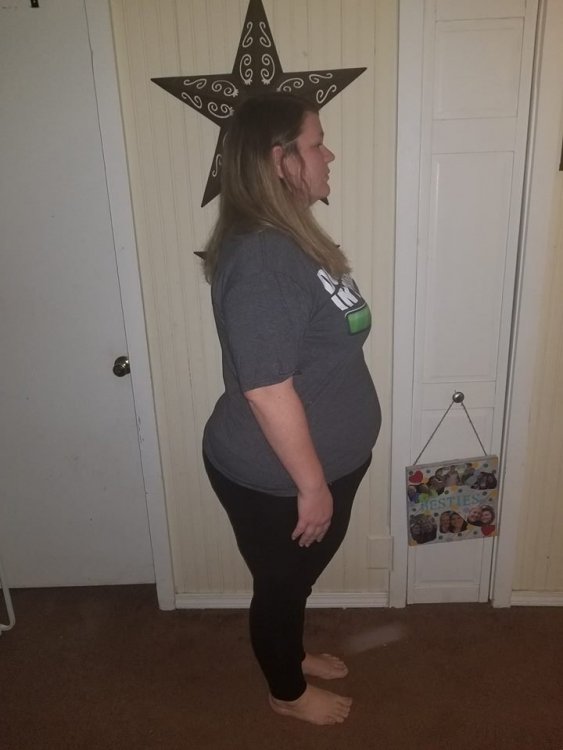 presurgery 2.jpg