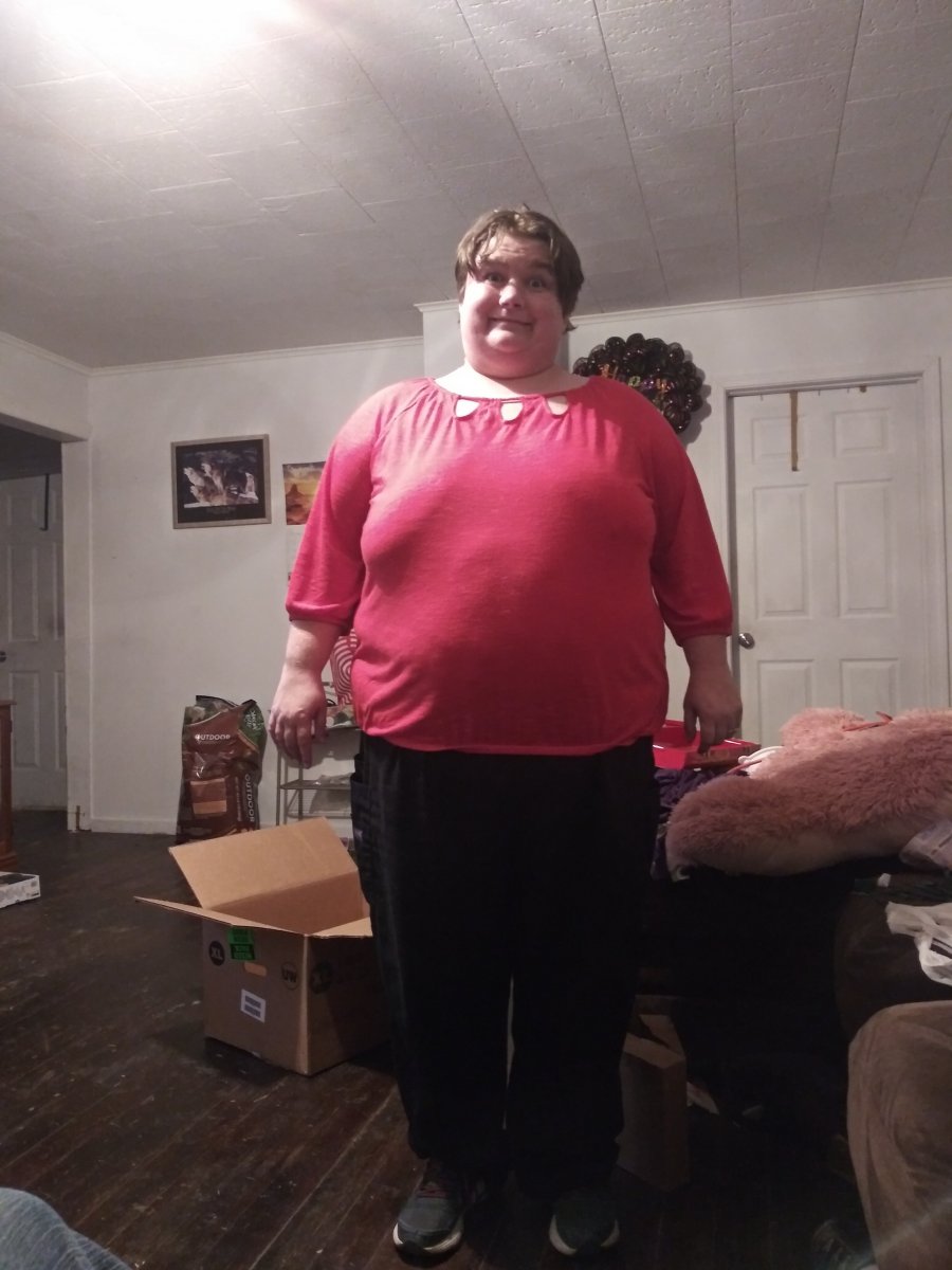 Before Surgery