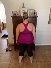 4/16 pre op 