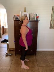 4/16 pre op