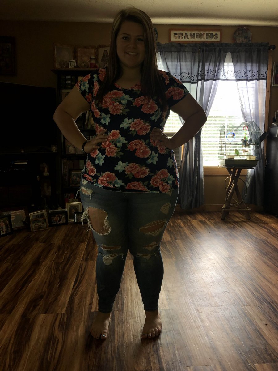 Before Surgery? (May 5, 2019)