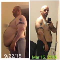 6 months post VSG