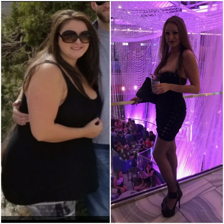 10 months post op.jpg