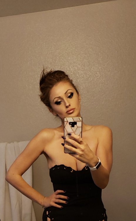 10 months post op front.jpeg