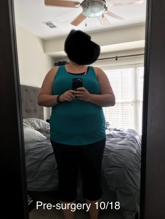 Preop No Face.JPEG