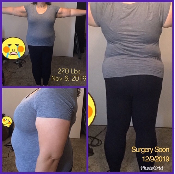 Progress Photos