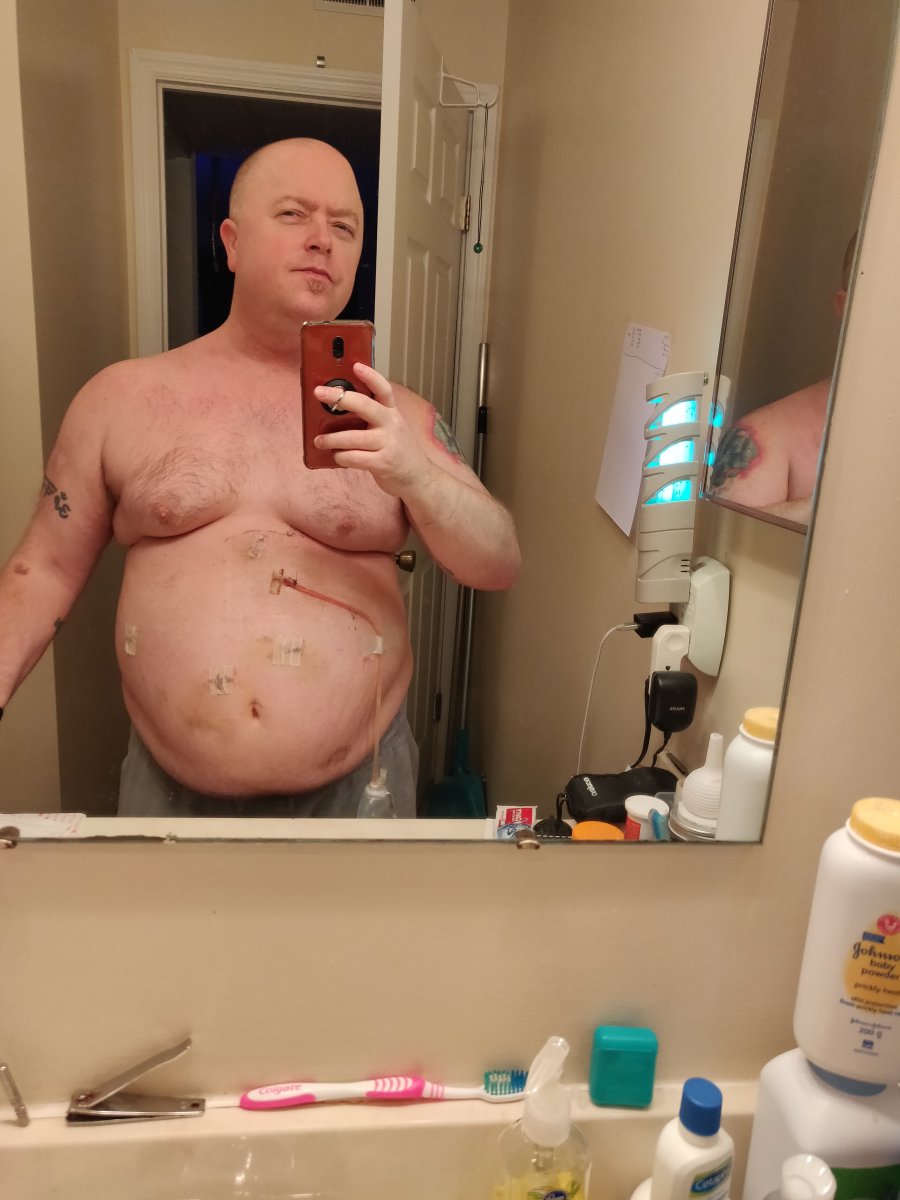 Before and progress