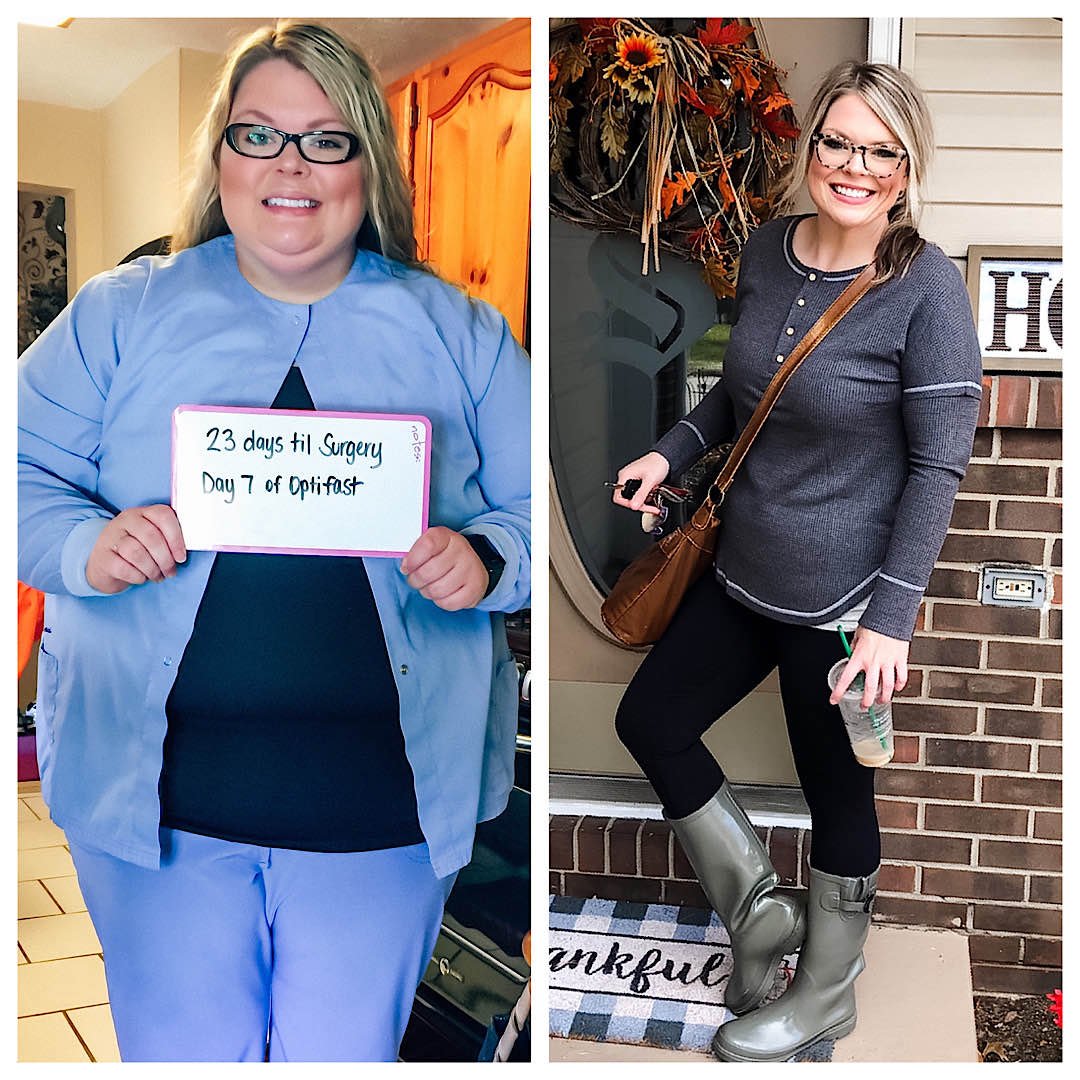 Before and After Photos
