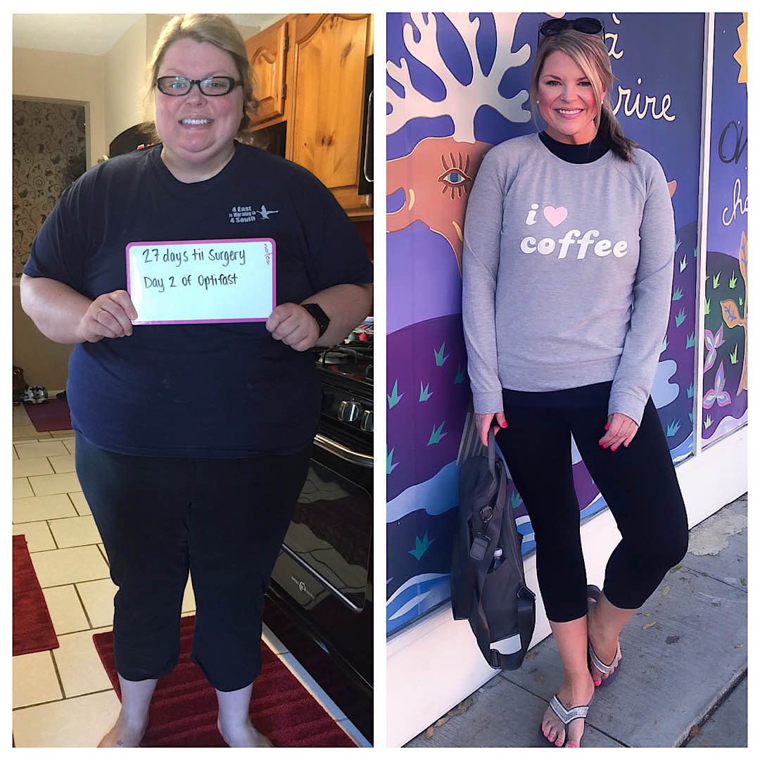 Before and After 