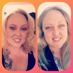 before and afternoon 5 months post op
