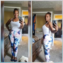 9 Months post Op