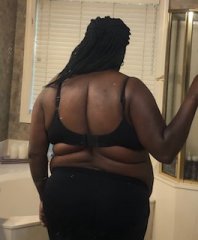Before Surgery