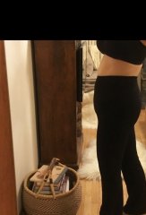 5 months post-op