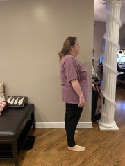 Week 2 Postop