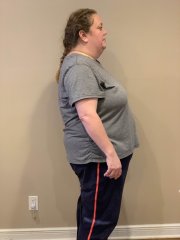 Week 1 Postop