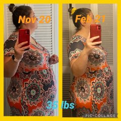Before surgery progress Nov. 2020 to Feb 2021