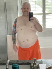 Front 2 weeks post-surgery
