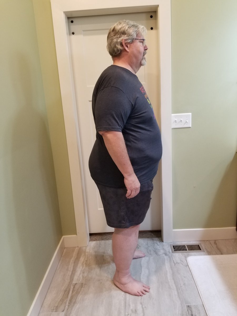 Pre-op  10-15-21