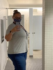 5 months post op
