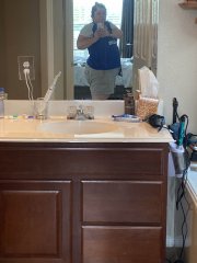 2 days before surgery 