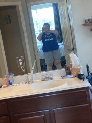 2 days before surgery 