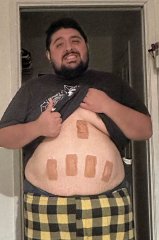 Day After Surgery!