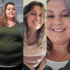 03.22.23 3 Months post op. 255.lbs-002.jpg