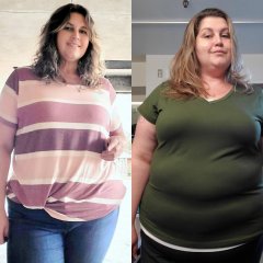 03.22.23 3 Months post op. 255.lbs-001.jpg