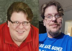 Before & After For Bariatric Pal Website.jpg