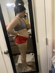 1 month Post Op